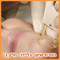 laser_hair_removal_c